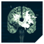 Brain Surgery