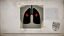 Conserving oxygen